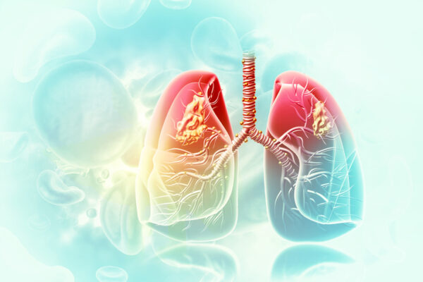With FDA Nod in Lung Cancer, Dizal Now Aims to Best a J&J Drug and Succeed Where Takeda Fell Short