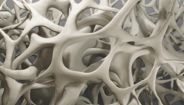 Atherosclerosis and Osteoporosis: A Tale of Two Conditions