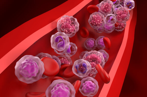 European Commission Approval Gives Blood Cancer Patients a New Cell Therapy Option