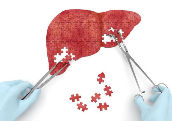 Long Regulatory Saga for Intercept Pharma Liver Drug Ends a Decade After Speedy FDA Approval